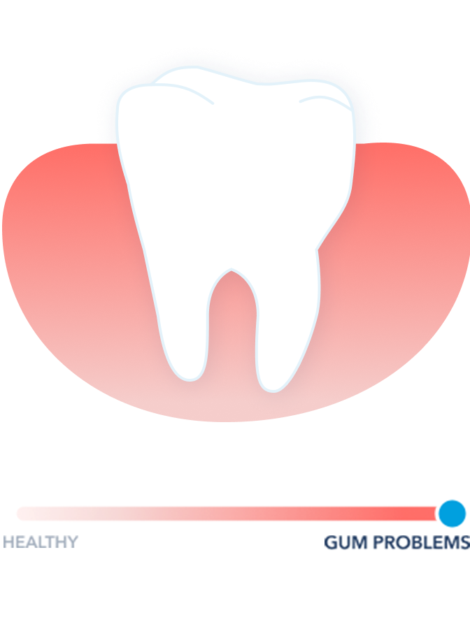 Gums at Risk